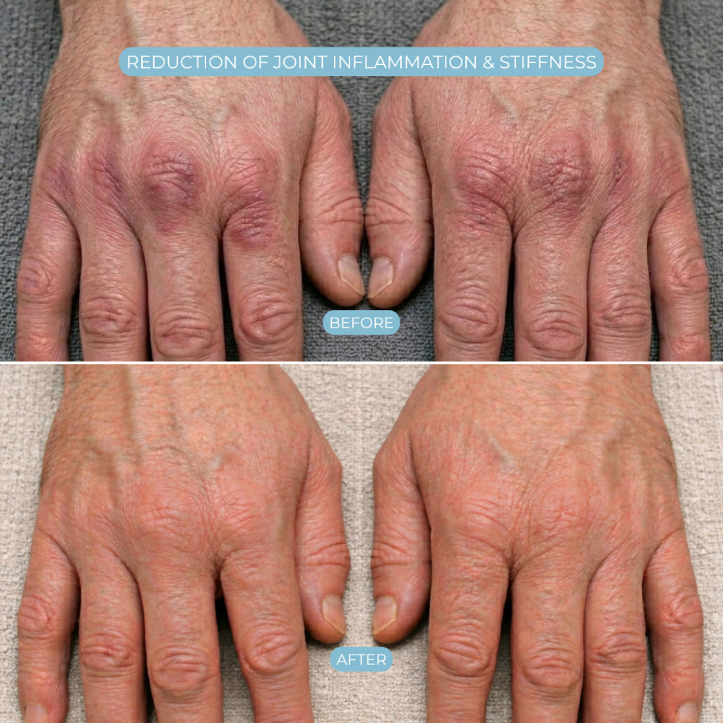 Relievia™ - Therapeutic Glove for Hand Pain Relief