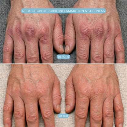 Relievia™ - Therapeutic Glove for Hand Pain Relief